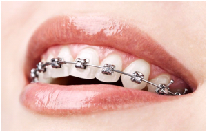 ortodoncja4