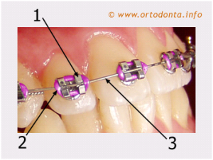 ortodoncja5